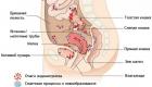 Эндометриоз матки, шейки матки, яичников при беременности: симптомы, отзывы